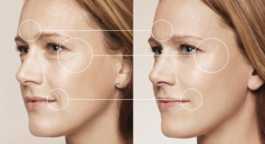 cirurgias plásticas